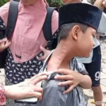 Teror Ulat Bulu, Siswa SD Terserang Gatal-Gatal