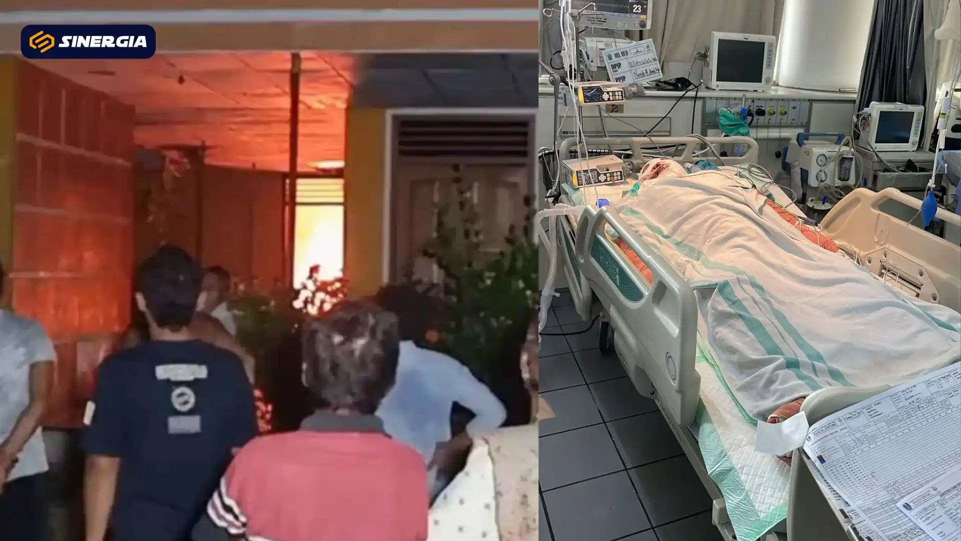 Alami Luka Bakar 75 Persen Akibat Kebakaran Rumah, Sugeng Dirujuk ke RSUD dr. Soetomo